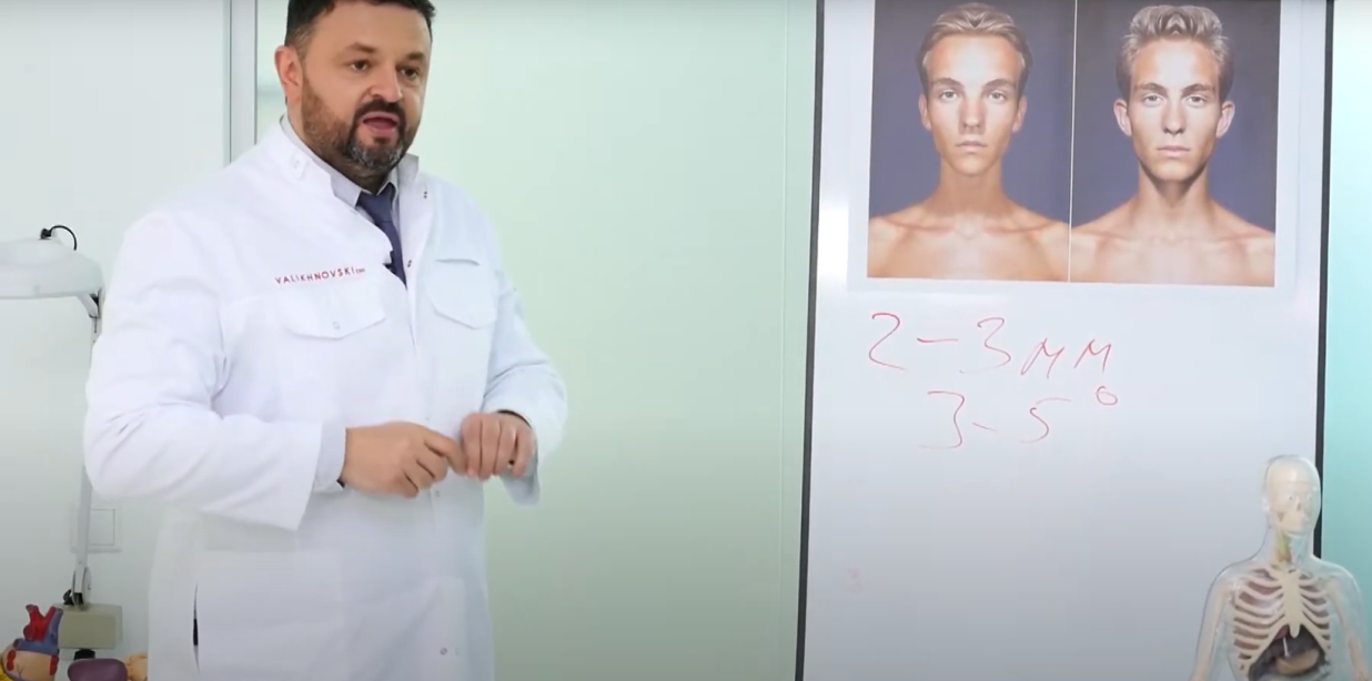 How are face transplant operations performed - Dr. Valikhnovski